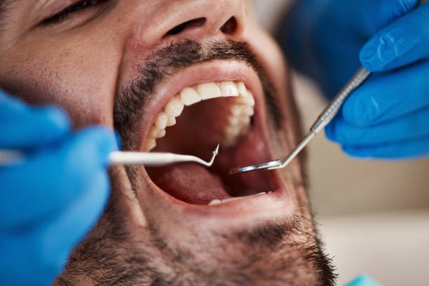 Best Dental Inlays and Onlays  in Mount Healthy, OH